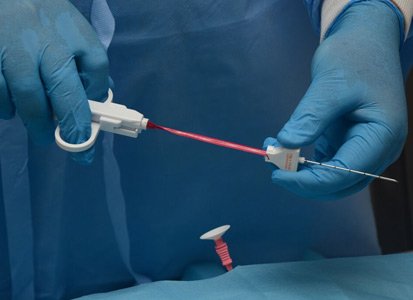 Intervention radiology